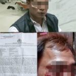 Tindak Tegas Oknum Kontraktor Di Pagaralam Yang Pukul Wartawan Yang Sedang Bertugas