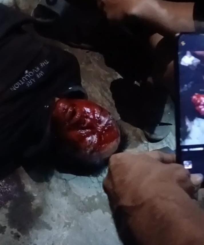 Pakai Pistol Diduga Mainan, Jambret di Salon “HILDA” Tegalrandu Ditangkap Warga Dibawa ke Rumah Sakit